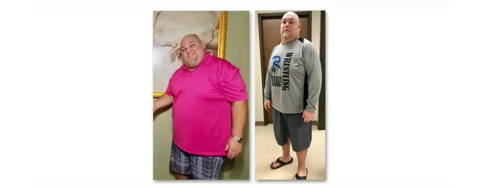 E.B. before and after