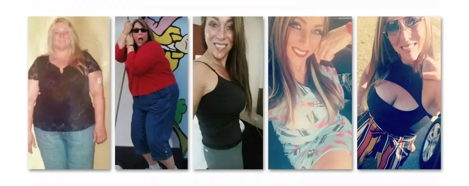 Michelle before and after