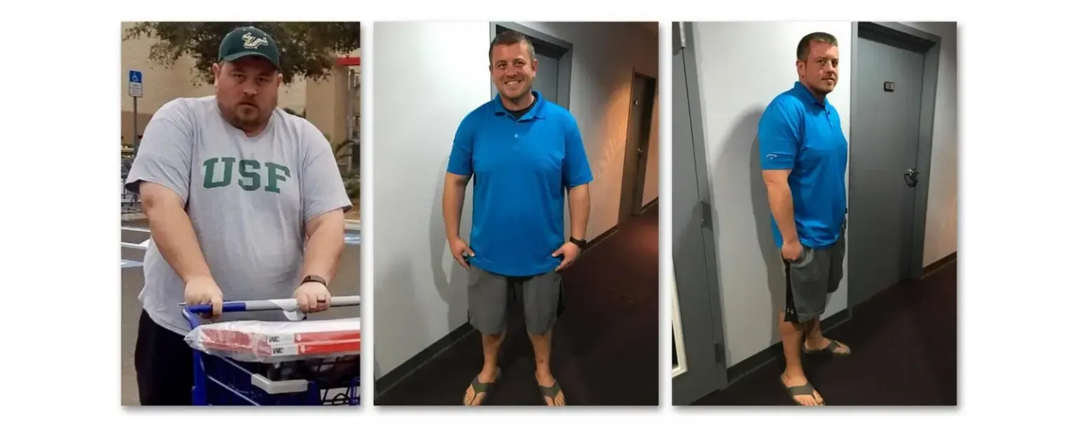 P.K. before and after